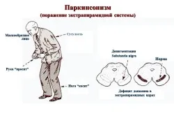 Parkinson-kór elleni hatóanyagok