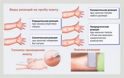 Lehetséges, hogy nedves bőrön teszteljék a víz hatását és óvintézkedések (hatás) Lehetséges, hogy nedves a bőrteszt a víz hatását és óvintézkedések