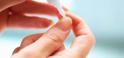 Nail tört a gyökere, hogy mit kell csinálni, hogyan kell visszaállítani a lemez