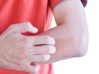 Ödéma nyak izomgörcs osteochondrosis (izom) A nyak duzzanata izomgörcs osteochondrosis