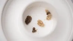 Sand vese - otthoni kezelés népi jogorvoslati (homok) A homok a vesében - otthoni kezelés népi jogorvoslati