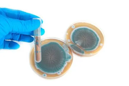 Fleming felfedezte a penicillint, mint egy antibiotikum vált