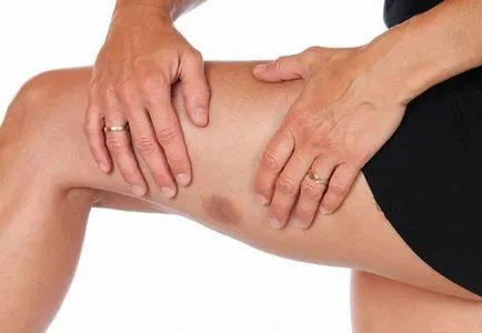Az okok a szisztémás vasculitis, a diagnózis és a kezelés (vasculitis) Az okok a szisztémás vasculitis, a diagnózis és a kezelés