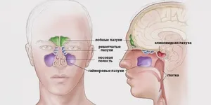 Radiológiai a paranazális szinuszok indikációi X-ray dekódoló PPN