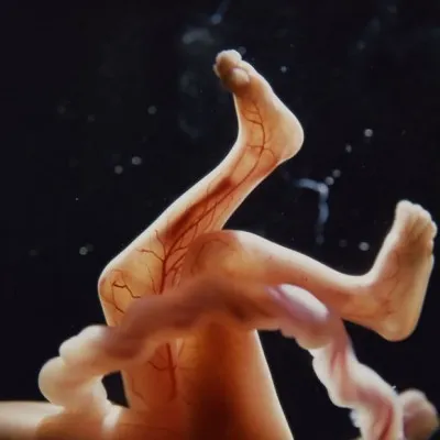 Vékony placenta -, hogy ez veszélyes