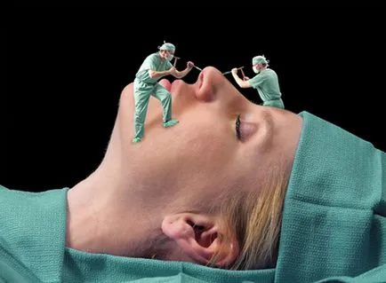 arcfiatalítás