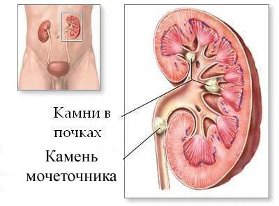 Gyomorgörcs, mit kell tennie, okok, tünetek, kezelés tabletták és a népi gyógyászat (kezelés) Gyomorgörcs, mit kell tennie, okok, tünetek, kezelés tabletták és népi jogorvoslati