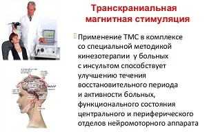 Koponyán keresztüli mágneses stimuláció az agy célok, véleményeket, funkciókat (mágneses) Koponyán keresztüli mágneses stimuláció az agy célok, áttekintésre, funkciók