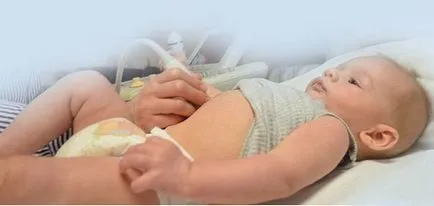 A megduplázódása a vesék okok, komplikációk, a kezelés
