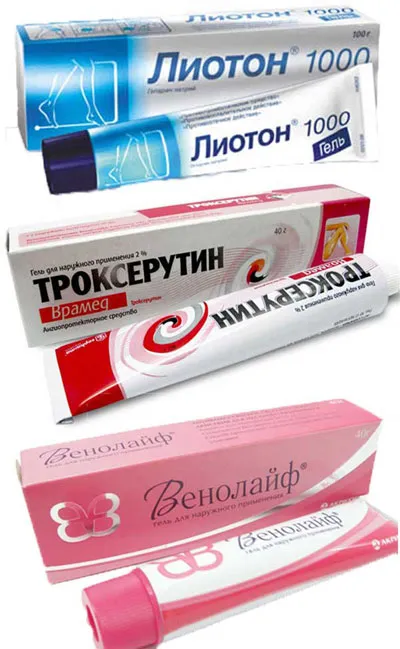 A visszértágulat kezelésére otthon