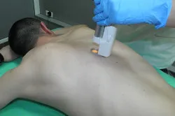 A szőr a hátán a férfiak okoz és eltávolítás