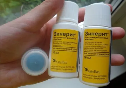 Pattanások az arcon egy felnőtt