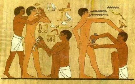 5 dolog, amit nem tud a körülmetélés (körülmetélése fiúk) 5 dolog, amit nem tud a körülmetélés