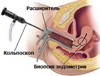 A biopszia, mi az,