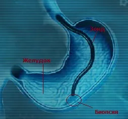A biopszia, mi az,