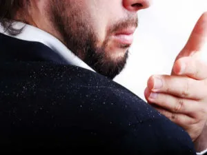 Biocon - sampon és spray hajhullás
