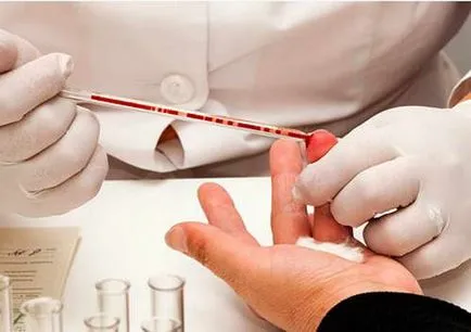 Biokémiai vizsgálatok a vér - a norma, megfejteni a biokémiai vizsgálatok a vér