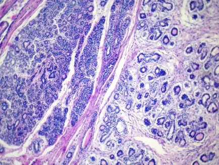 Biopsziás - módszer megerősítését rák bármely formáját
