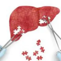 Fájdalom a máj - mit kell tenni otthon inni és étrend (fájdalom a máj, hogy mit kell csinálni otthon rosszul ivás után diétát ital, hogy az antibiotikumok embereknél) Fájdalom a máj - mit kell tenni otthon inni és diéta