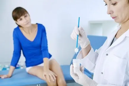 Gyakori, hogy miért szájpenész szájpenész visszatér, mit kell tenni