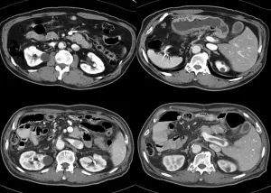 MRI mutatja, hogy a hasüregbe egy kontraszt készítmény, amely hatóságok ellenőrzik ár