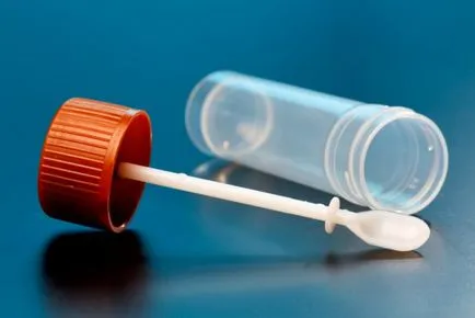 Mi Giardiasis és hogyan kell kezelni, hogy - tünetek és kezelés (Giardiasis) Mi Giardiasis és hogyan kell kezelni, hogy - tünetek és kezelés