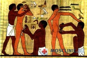 Mi az a körülmetélés, és miért van rá szükség (körülmetélés) Mi az a körülmetélés, és miért van rá szükség