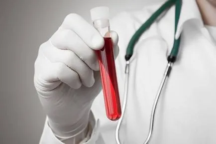 Cystitis nőknél a vér okok, tünetek, kezelés (vér) Cystitis nőknél a vér okok, tünetek, kezelés