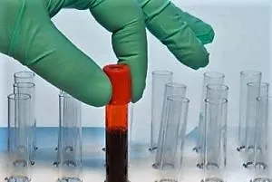 D-dimer emelkedett - okok, melynek mértéke a terhesség hétről-hétre, a mutatók táblázata, cardio ellátás