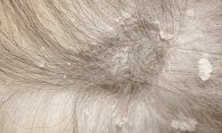 Dermatitis macskák tünetei és kezelése fotó (fotó) Dermatitis macskák fotó tünetek és a kezelés