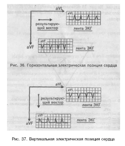 Elektromos szív elektromos tengelye és helyzetét (tengely) Elektromos tengely és elektromos szív helyzetét