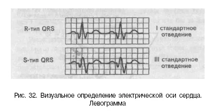 Elektromos szív elektromos tengelye és helyzetét (elektromos) Elektromos tengely és elektromos szív helyzetét