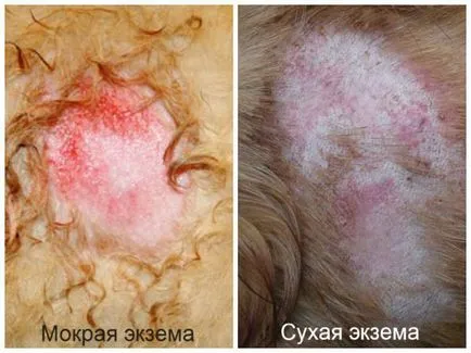 Ekcéma kutyáknál okoz, a tünetek, a kezelés (Dogs) Ekcéma kutyáknál okoz, a tünetek, a kezelés