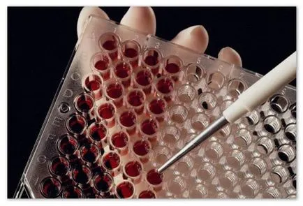 Izoprinozin gyerekeknek 1 (gyermek) Izoprinozin gyerekeknek 1