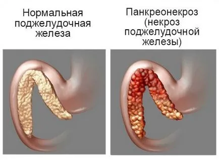 Hogy fáj a hasnyálmirigy emberben a fő tünetei (Human) Hogy fáj a hasnyálmirigy emberben a fő tünetei