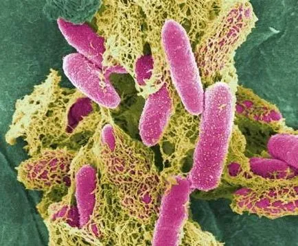Hogyan Staphylococcus aureus