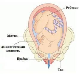Hogyan lehet megérteni a lépcsős dugó fotók, szülés előtt (parafa) Hogyan lehet megérteni a lépcsős dugó fotók, szülés előtt