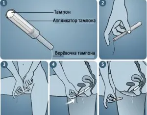 Hogyan kell használni a tampont