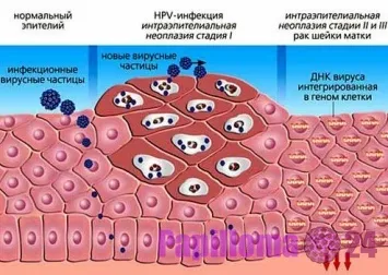 Hogyan lehet eltávolítani a vírusokat és trójai a számítógépről (törlés) Hogyan lehet eltávolítani a vírusokat és trójai a számítógépről