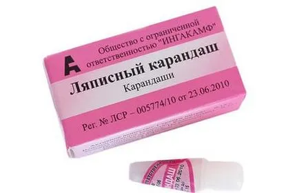 Mivel otthon eltávolítani papilloma gyógyszertár és népi jogorvoslati (eltávolítás) Mivel otthon eltávolítani papilloma gyógyszertár és népi jogorvoslati