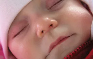 Mi az allergia, hogy mosópor gyermek fotó, módszerek harc