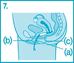Hogyan lehet behelyezni egy tampon - utasításokat, hogyan kell használni a tampon, akkor adjon meg egy tampon a hüvelybe