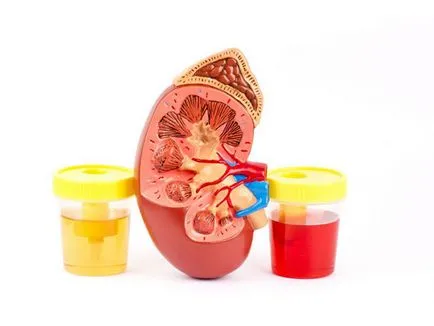 Vér a vizeletben okoz a kezelés, a tünetek