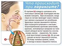 Gégegyulladás, hogyan kell kezelni - blogok - filmeket nézni online kiváló minőségű ingyen