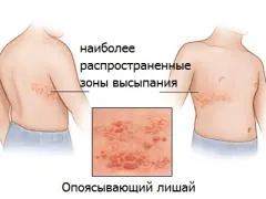 Gyógyszerek megfosztva egy személy, megfosztva típusú, tünetek és diagnózis módszerek (típusok) Gyógyszerek megfosztva egy személy, megfosztva típusú, tünetek és diagnózis módszerei