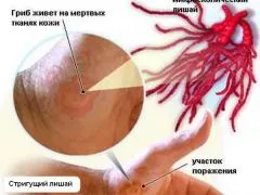 Gyógyszerek megfosztva egy személy, megfosztva típusú, tünetek és diagnózis módszerek (stripping) Gyógyszerek megfosztva egy személy, megfosztva típusú, tünetek és diagnózis módszerei
