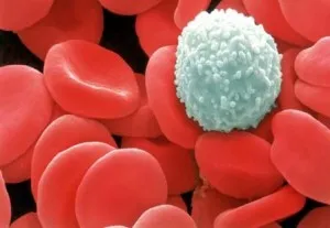 vasculitis kezelésére