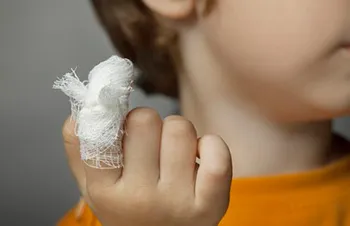 Szemölcsök kezelésére gyermekeknél és különösen alkalmas