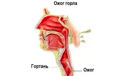 Köhögés otthoni kezelés a felnőtt alapvető technikák (kezelés) Köhögés otthoni kezelés felnőtt alapvető technikákat