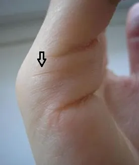 Vonal szeretet viszont tenyérjóslás 1 (kézi vonal szerelem) Vonal szeretet viszont tenyérjóslás 1